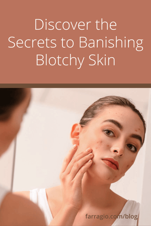 Pin to Pinterest so you don't lose this important information about banishing blotchy skin