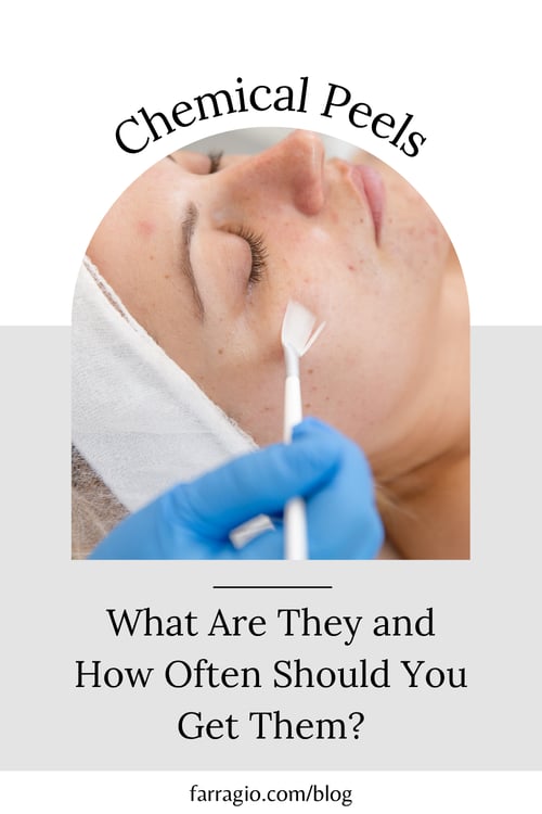 pin_chemicalpeel_1000x1500_03