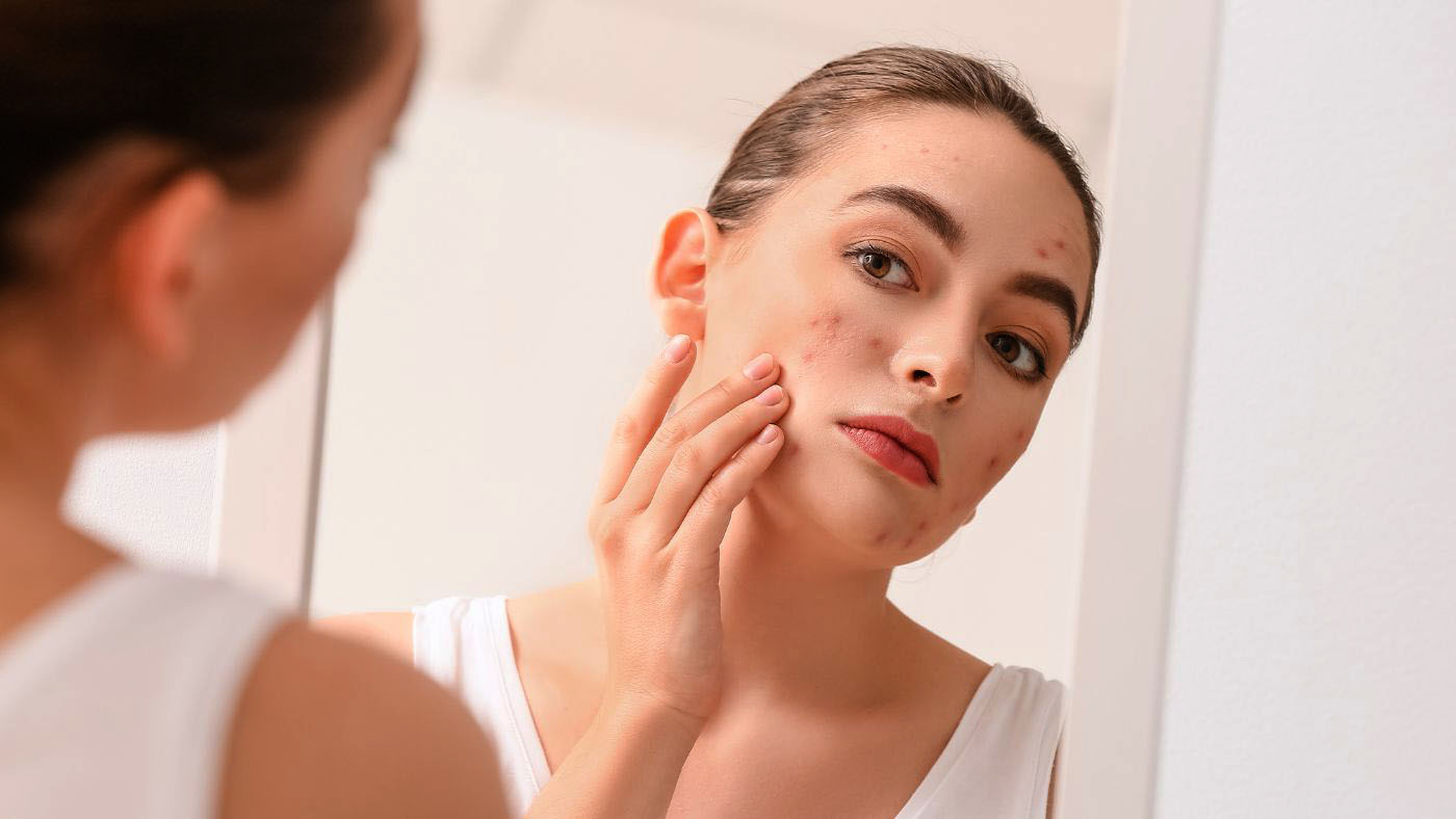 Helpful tips for correcting blotchy skin